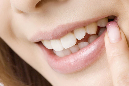 インプラントや矯正も対応